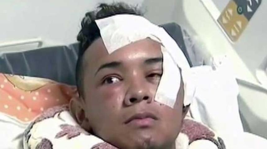 G&ouml;z&uuml;ne bı&ccedil;ak saplandı, beyni delindi