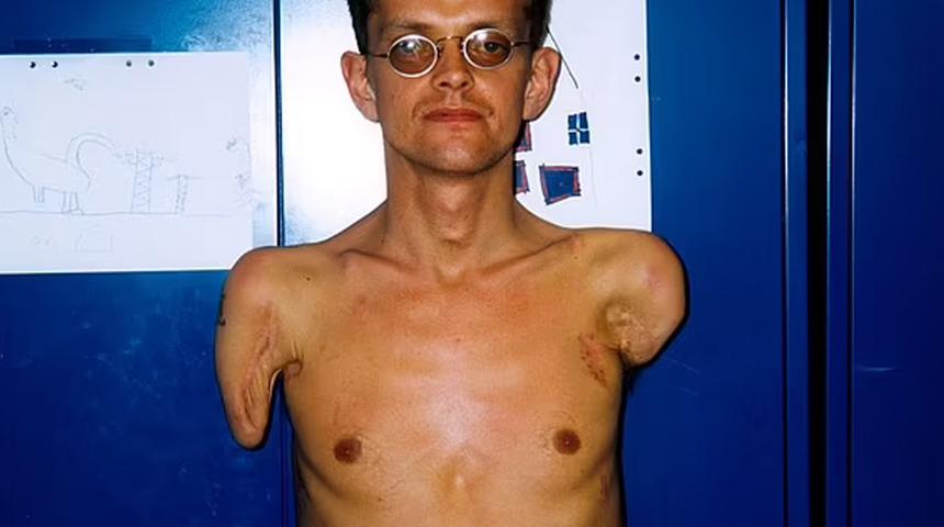 Mucize adam bugün kendisine ait olmayan kollarıyla spor salonunda ağırlık kaldırıyor!