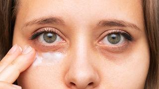 Pandemi nedeniyle arttı! Gözaltı morluklarınızı evde çözebilirsiniz 