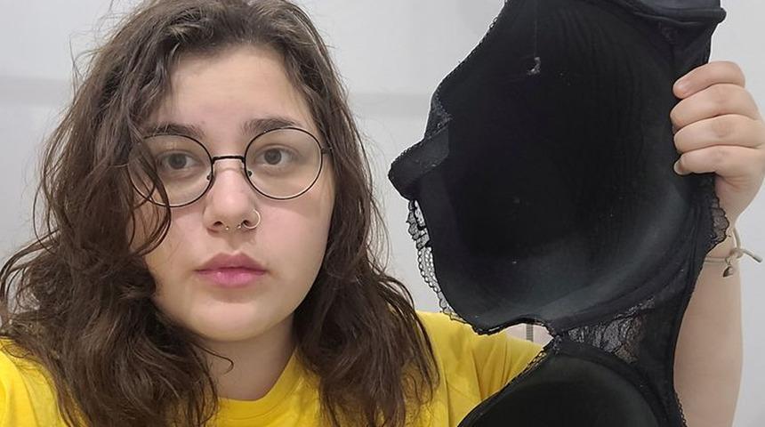 Göğüsleri o kadar büyük ki 22 yaşında bastonla yürüyor! İnanılır gibi değil...