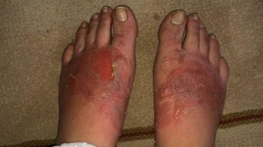 Zehirli ayakkabılar konusunda uzmanlar konuştu