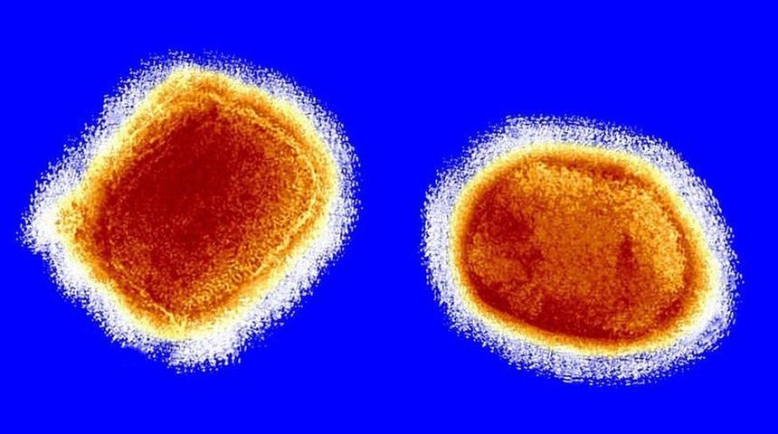 Maymun &ccedil;i&ccedil;eği vir&uuml;s&uuml;: D&uuml;nya Sağlık &Ouml;rg&uuml;t&uuml; 'Vakalar artabilir ancak endişeye kapılmamak gerek' diyor