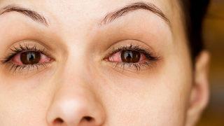 Görme kaybı yaşayabilirsiniz! Göz kaşıntınız varsa…