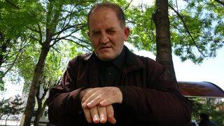 Teşhis konulamadı, hayatı zindan oldu! 11 aydır durmadan kaşınıyor