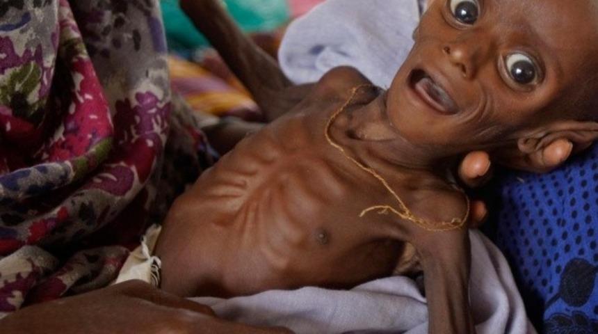 400 bin &ccedil;ocuğa acil yardım gerek