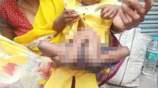 Doktorlar bile şaşırdı! Beline bağlı iki kol ve bacakla doğdu