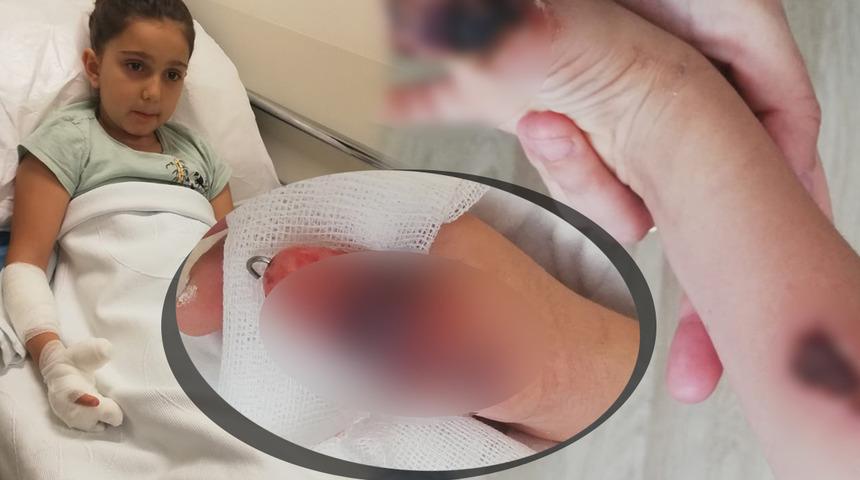 İstanbul'da akılalmaz olay! K&uuml;&ccedil;&uuml;k kızı MR'da yaktılar