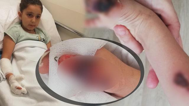 İstanbul'da akılalmaz olay! Küçük kızı MR'da yaktılar