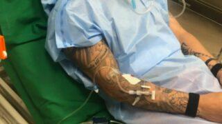 Gerçek 30 yıl sonra röntgen sonucuyla ortaya çıktı! Doktorlar solunum tüpünü içinde unutmuş