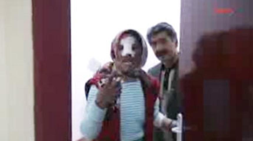 Eşi ve kayınbiraderi burnunu kesti