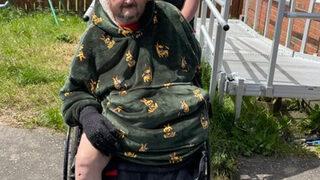 Derisi yavaş yavaş çürüyüp düşüyor! Tek göz odada yavaş yavaş ölmeyi bekliyor