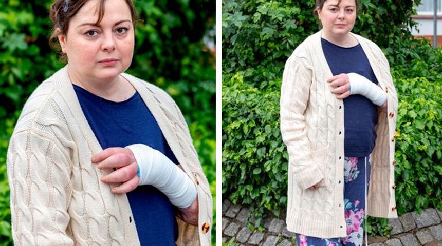 Sadece yardım etmek istemişti! Sekiz kez ölümden dönen kadın şimdi ''Kolumu kesin!'' diye yalvarıyor