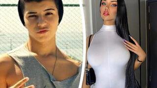 Beren Güney bir ameliyat daha oldu! Cinsiyet geçiş operasyonu sonrası belden aşağısını paylaştı