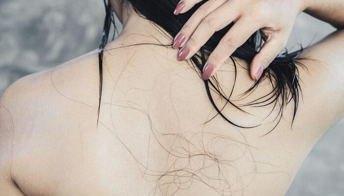 Saç dökülmesiyle mücadele eden kadınlara mükemmel ipuçları! Saç dökülmesi nasıl önlenir?