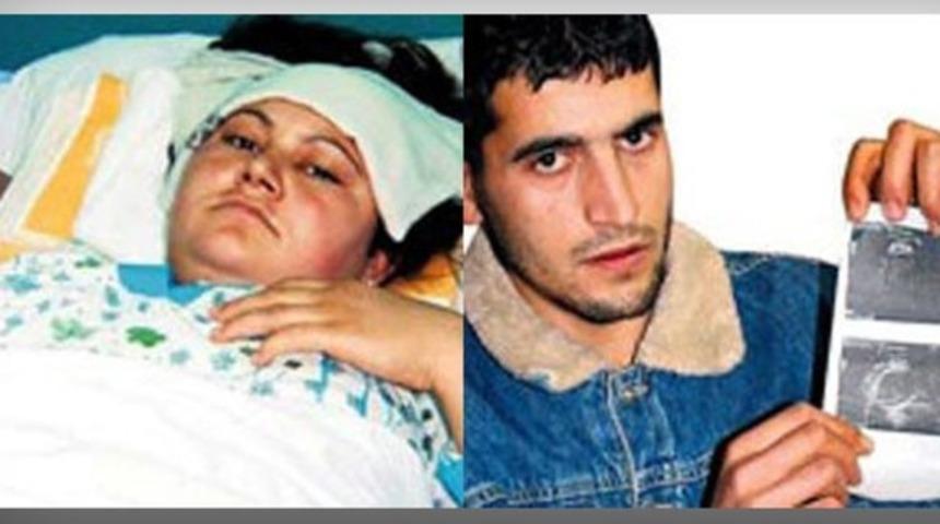 Doğumda bebeğin kafası koptu