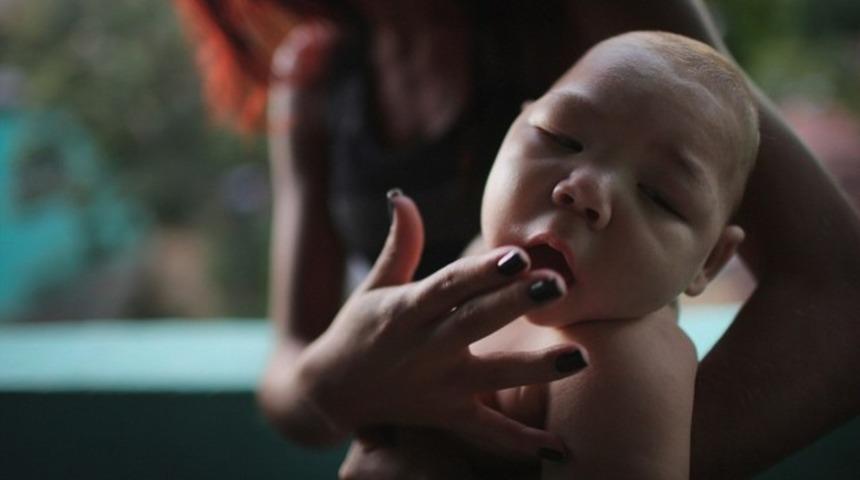 Zika vir&uuml;s&uuml; Avrupa'da