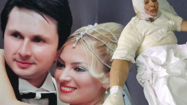 Eski eşini yakıp, babasına 'git gelinini kurtar' dedi! Kabusu yaşayan Elvan: Mangal yanıyormuş gibi canice izledi