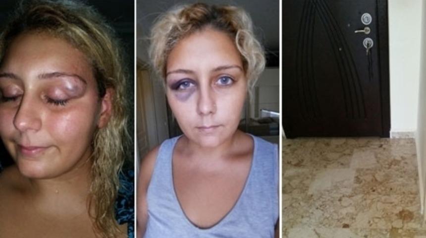 Şiddet mağduru K&uuml;bra Yılmaz'ın eski sevgilisi yakalandı