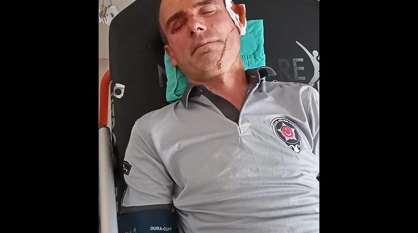 Hastanede dehşet! Güvenlik görevlisini bu hale getirdi, sebebi 'pes' dedirtti