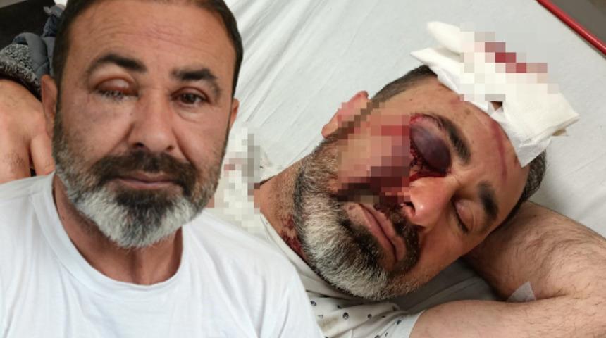 Kavgayı ayırmak isterken, az kalsın gözünden oluyordu! 'Olan bize oldu, bu Allah’ın bana cezası'