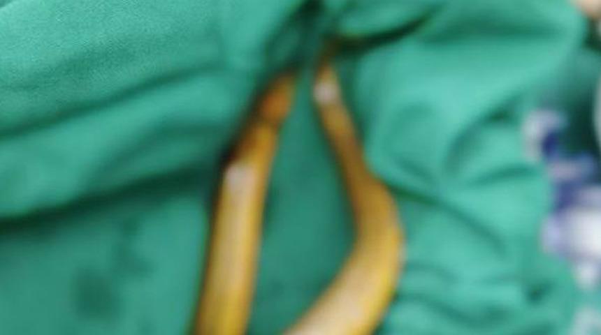 38 cm’lik yılanbalığı içinden canlı çıktı! Gerekçesi akıllara durgunluk verdi