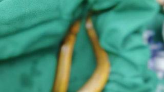 38 cm’lik yılanbalığı içinden canlı çıktı! Gerekçesi akıllara durgunluk verdi