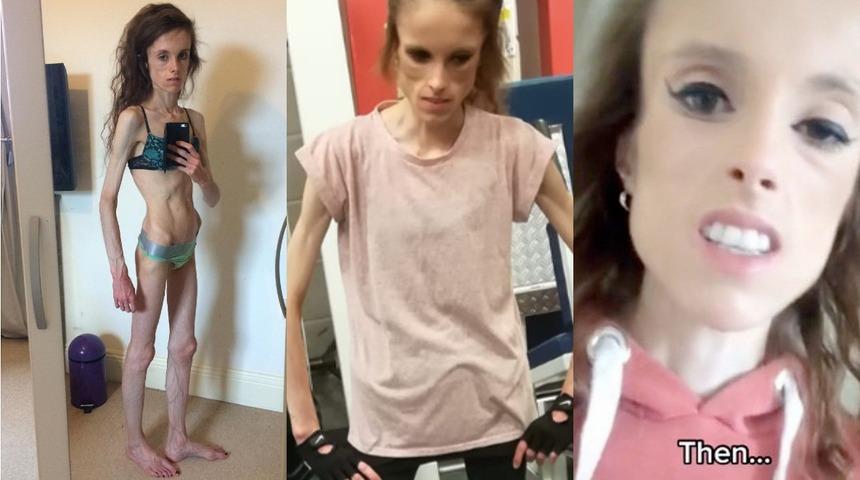 D&ouml;n&uuml;ş&uuml;m&uuml; dudak u&ccedil;uklattı! Anoreksiyadan v&uuml;cut geliştiriciliğine destansı değişim