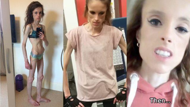 Dönüşümü dudak uçuklattı! Anoreksiyadan vücut geliştiriciliğine destansı değişim