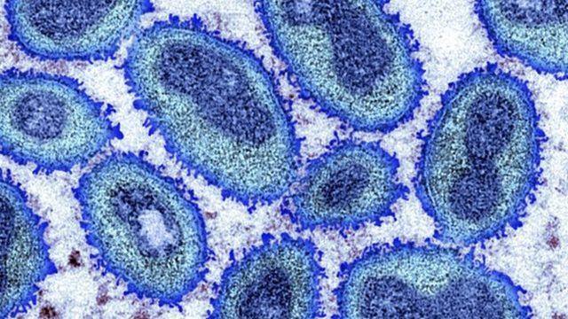 Maymun çiçeği virüsü: Afrika dışındaki vaka sayısı üçe katlanarak 780’e yükseldi