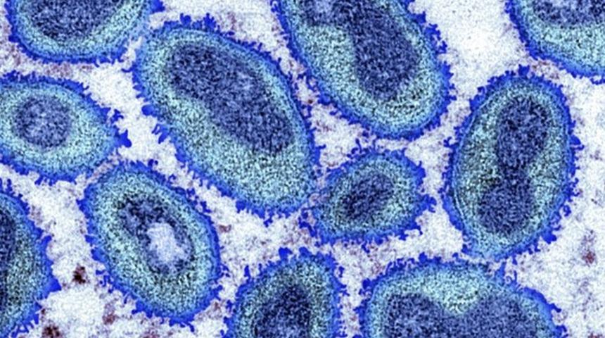 Maymun çiçeği virüsü: Afrika dışındaki vaka sayısı üçe katlanarak 780’e yükseldi