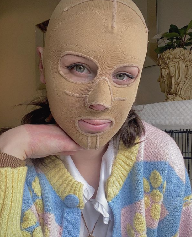 Yanardağ patlamasında vücudunun büyük bölümü yanmıştı! Yıllar sonra maskesini çıkarttı G4