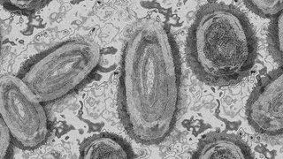 Maymun çiçeği virüsüne karşı dikkat çeken hamle... Aşı stoku yapmaya başladılar!