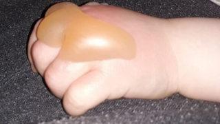 Güneş yanığı sandılar ama gerçek bambaşka çıktı! Küçücük bebek bu hale geldi