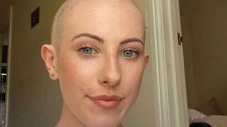 Sivilce sandı! Olacakları asla tahmin edemezdi