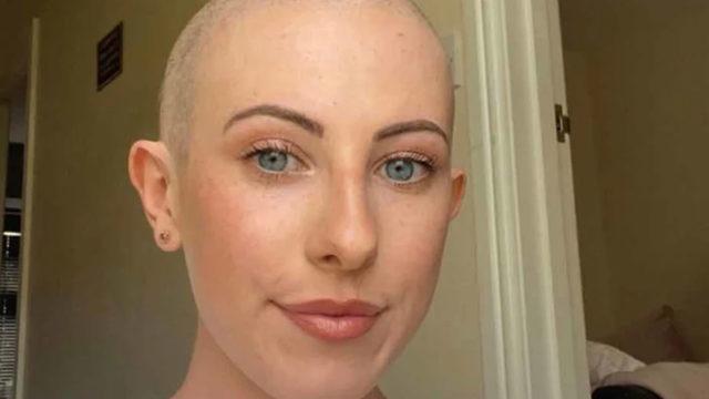 Sivilce sandı! Olacakları asla tahmin edemezdi