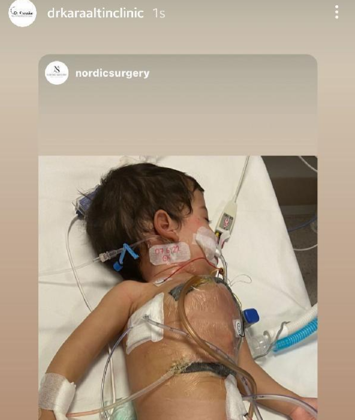 Aynı bedende yaşayan siyam ikizleri, Türkiye’de ayırıldı! Ameliyat tam 9 saat sürdü G1