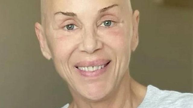 Billur Kalkavan taburcu oldu 