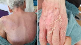 Huzurevinde yaşlı kadını ölüme götüren olay! 'Yanık değil' demişti! Rapor gerçeği ortaya çıkardı