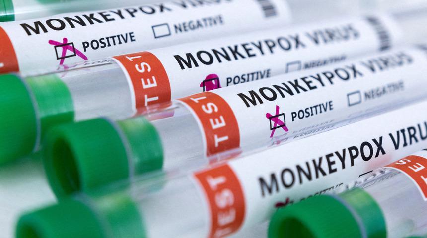 Son dakika: Maymun çiçeği dibimize kadar geldi! Komşuda virüs alarmı