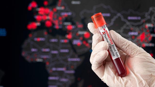 Maymun çiçeği paniği! Meksika'da hastaneden kaçıp ABD'ye gitti