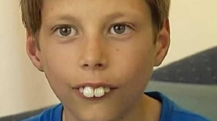 Dişleri nedeniyle alay konusu olmuştu! Düzelttirmek için...