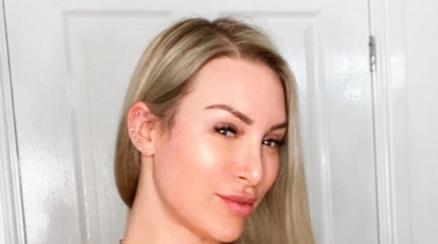 Sosyal medya fenomeni Tracy Kiss, görüntüsünü değiştirmek için Türkiye’ye geldi! Üç ameliyat birden oldu