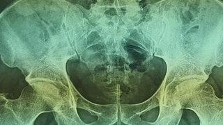 Evde uyguladığı yöntem şaşırttı! Cinsel organına soktuğu tel yüzünden…