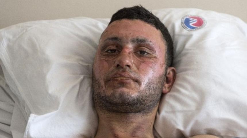 Saldırıda yaralanan genç o anları anlattı