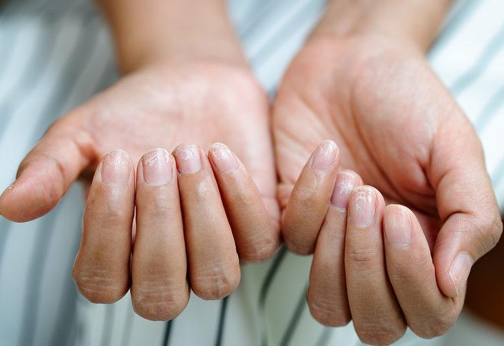 Göz ardı etmeyin! Hasta olduğunuzu belirten işaretler G2