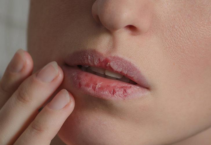 Göz ardı etmeyin! Hasta olduğunuzu belirten işaretler G4