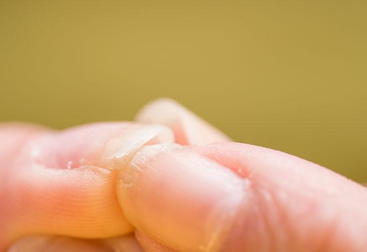 Göz ardı etmeyin! Hasta olduğunuzu belirten işaretler G5