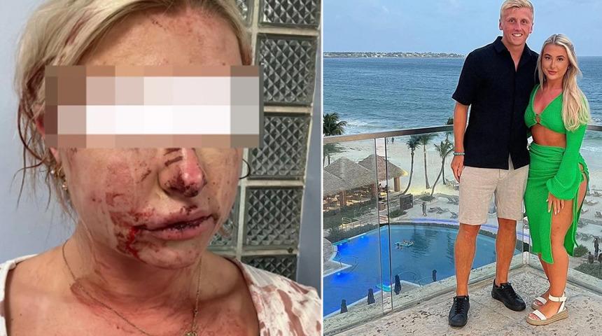 Derby County futbolcusu Louie Sibley'in kız arkadaşı canını zor kurtardı! İğrenç saldırı...