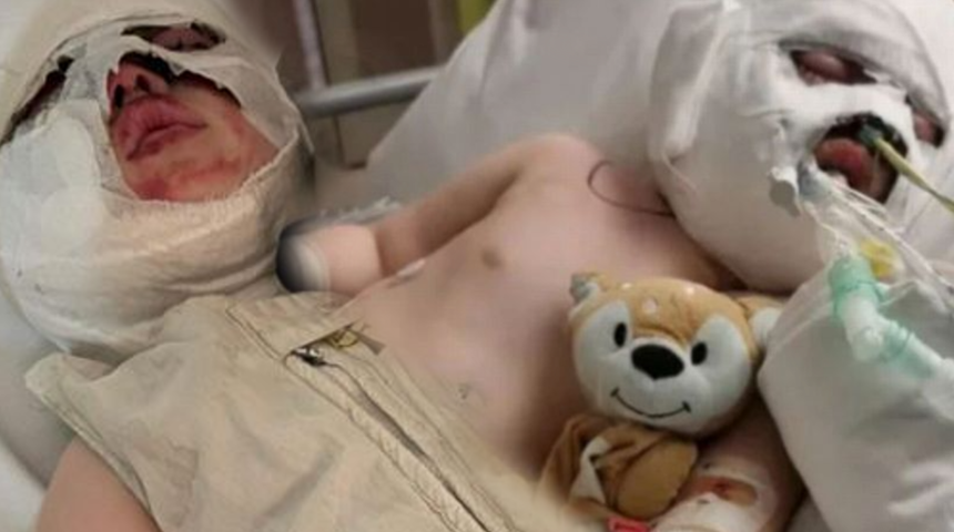 Ailelerinin dikkatsizliği onları bu hale getirdi! Kardeşler ölümle burun buruna