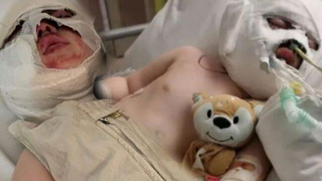 Ailelerinin dikkatsizliği onları bu hale getirdi! Kardeşler ölümle burun buruna